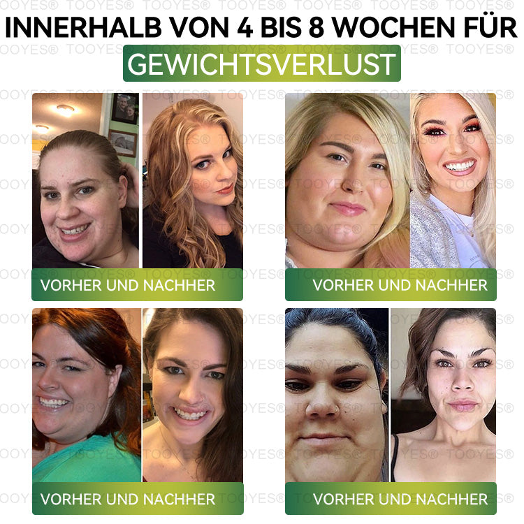Offizieller Shop | TOOYES® Meglutid GLP-1 aktivierende orale Lösung – Moringa • NAD+ • Yerba Mate – Natürliche Unterstützung für Gewichtsabnahme, Anti-Aging & Zuckerstoffwechsel