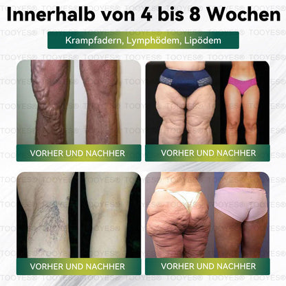 Offizieller Shop | TOOYES® Meglutid GLP-1 aktivierende orale Lösung – Moringa • NAD+ • Yerba Mate – Natürliche Unterstützung für Gewichtsabnahme, Anti-Aging & Zuckerstoffwechsel